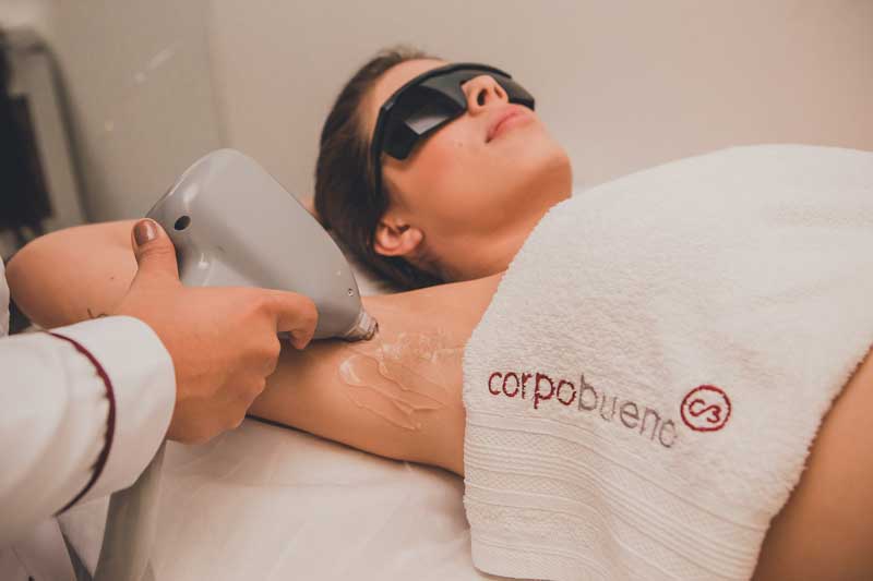 Laser Hair Removal
