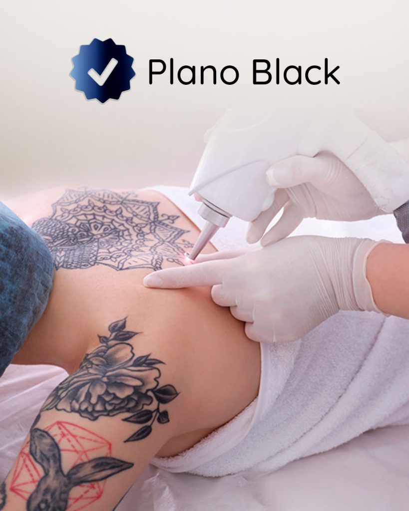 Plano Black Remoção de Tatuagem