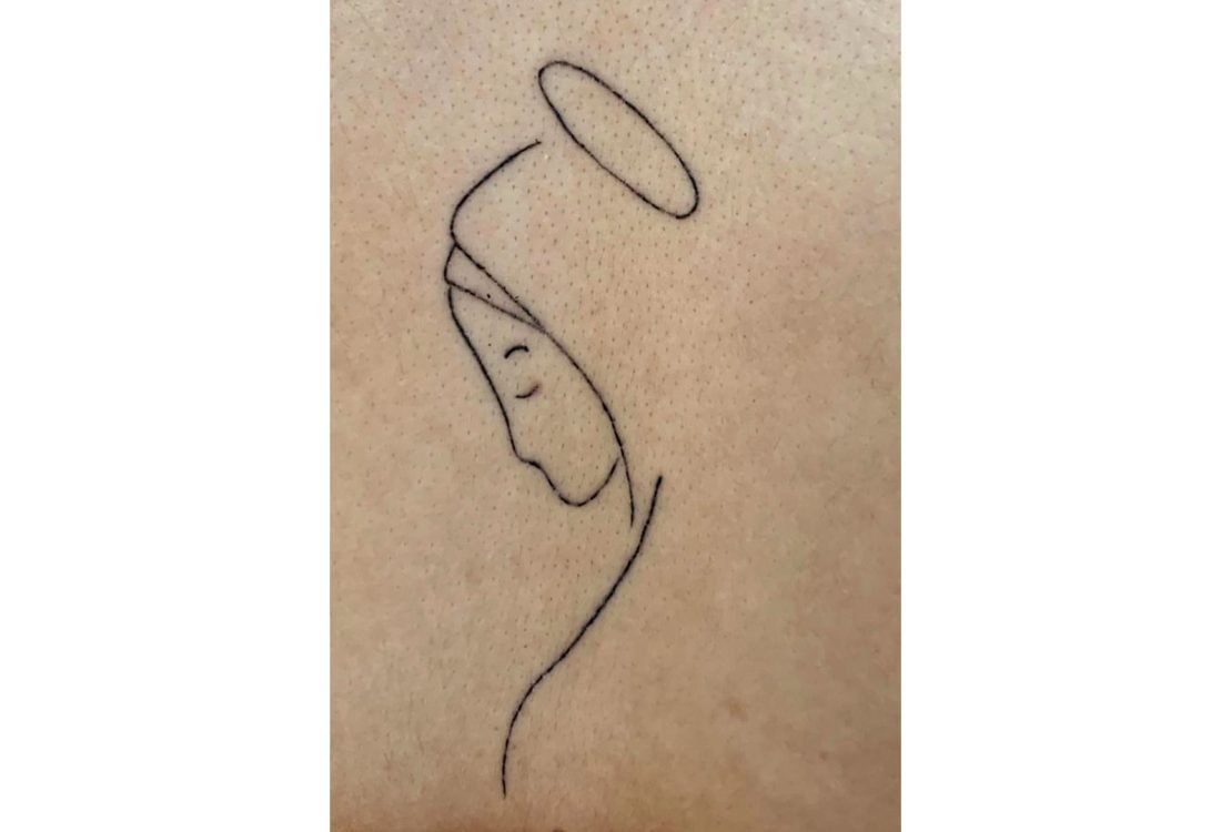 Tatuagem Remoção - Renove a sua pele - antes