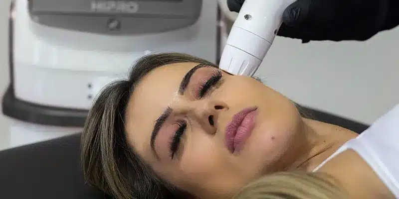 6 Motivos para fazer Ultrassom Microfocado na Clínica de Estética Corpo Bueno em Campinas